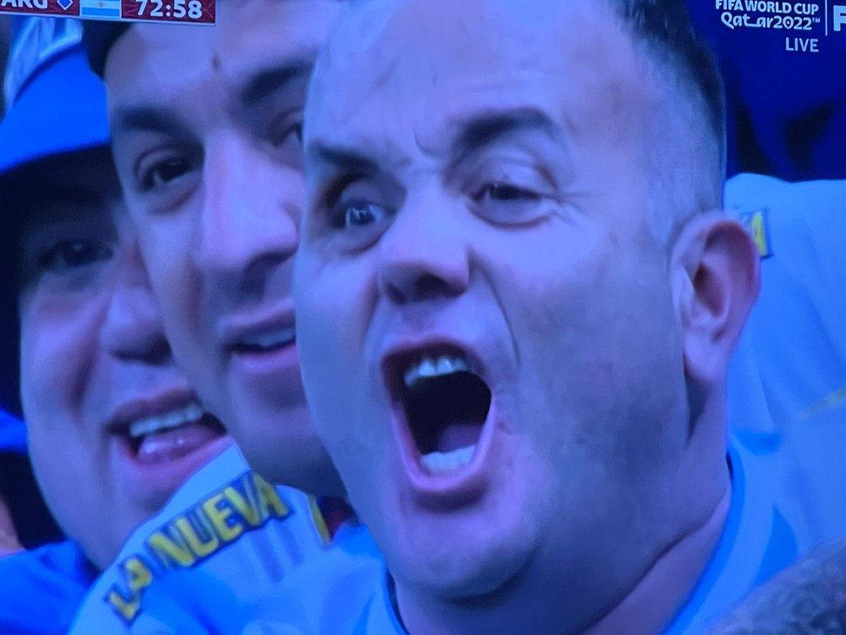 HardFactorMark's tweet photo. This Argentina fan looks like he’s been in a knife fight or three https://t.co/7YaIKQ7VbF