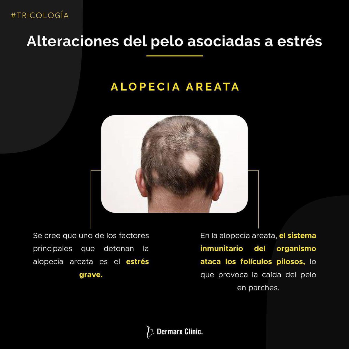 El estrés es el gran detonante de muchísimas patologías para las cuales tenemos predisposición genética.
#adaptogens #stress #stressprotection #adaptogenos #caidadepelo #estres #caidadepeloporestres #efluvio #efluviotelogeno #alopecia #alopeciaareata #tricotilomania #dermatology 
