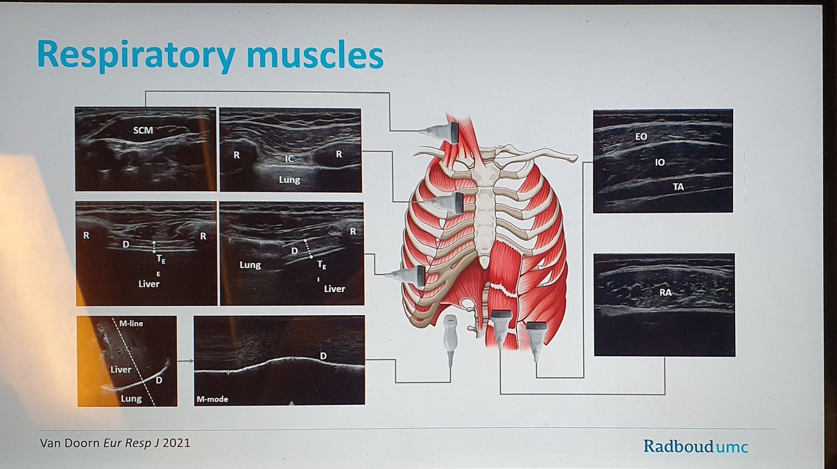 Jonne Doorduin (@drjonnedoorduin) on Twitter photo Finishing my talk for the Belgian Respiratory Physiotherapy Days in the train to Brussels. Looking forward to talk about and demonstrate ultrasound of the respiratory muscles. <a href="/DLanger6/">Daniel Langer</a> Finishing my talk for the Belgian Respiratory Physiotherapy Days in the train to Brussels. Looking forward to talk about and demonstrate ultrasound of the respiratory muscles. <a href="/DLanger6/">Daniel Langer</a>