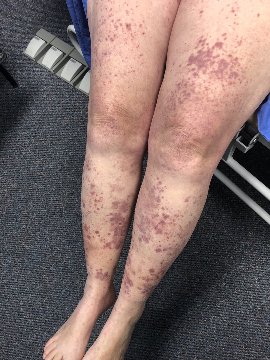 Janet Pope tweet media