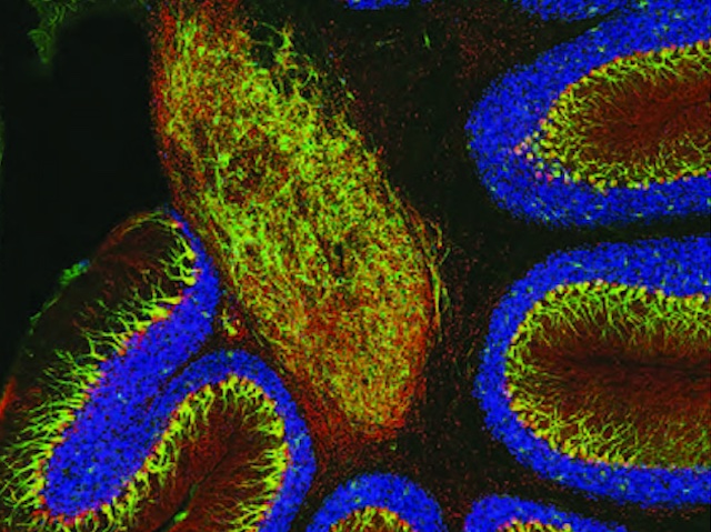 BPoD_s's tweet photo. How sacsin #genemutation of #ARSACS, a rare inherited disease, underlies associated #neurodegeneration. Image Samantha Boeshore @UNC  research by Lisa Romano, Wen Yih Aw &amp; Kathryn Hixson et al @QMULWHRI @UNC in @CellReports.More https://t.co/07GZLSLRub with @MRC_LMS &amp; @AntDLewis https://t.co/nqu0THNNeq