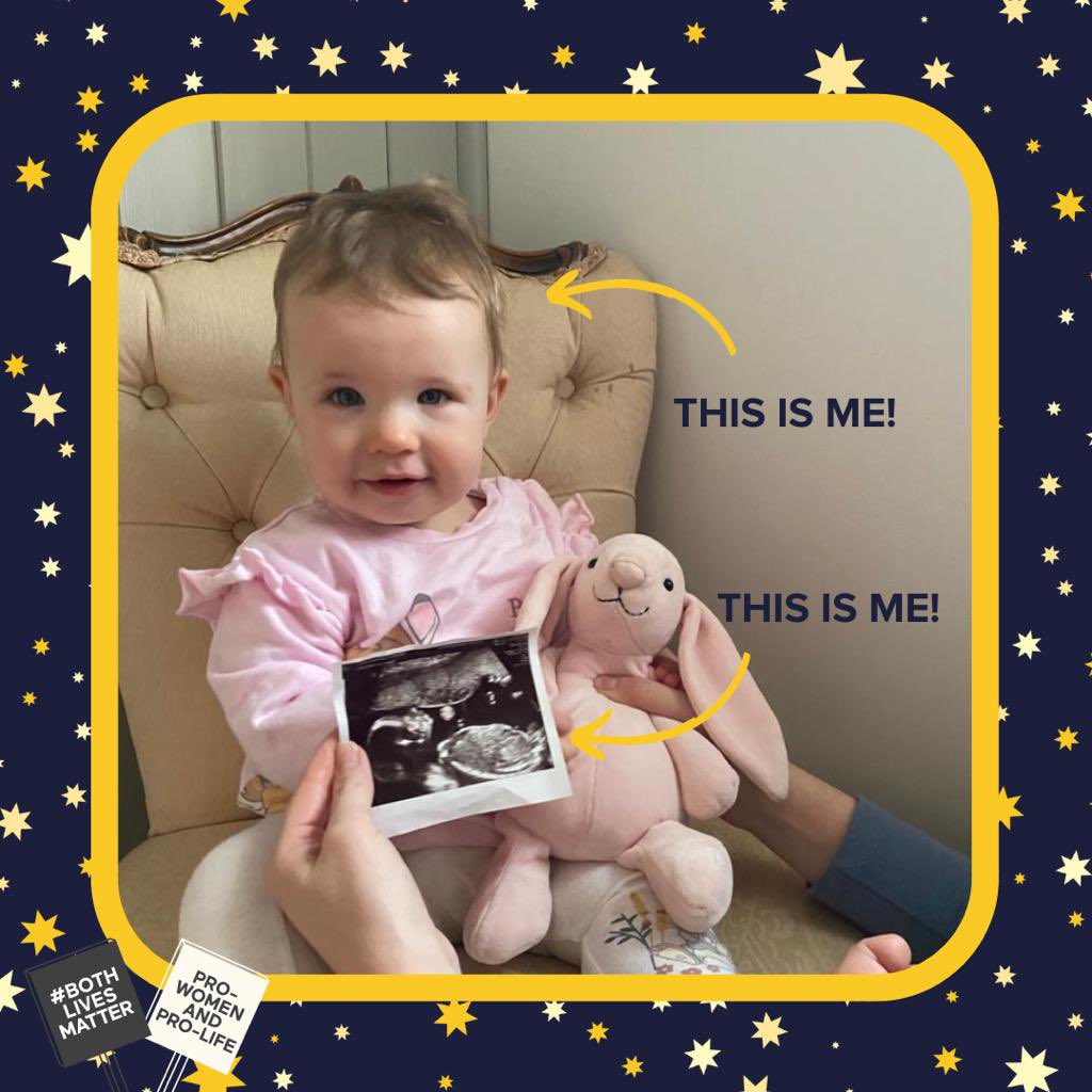 BothLives's tweet photo. ⭐️THIS IS ME ⭐️
Meet Alice!
Christmas is a celebration of life & we want to celebrate the life that begins pre-birth.
Alice is the same person pre & post birth.
Join us this month as we celebrate the miracle of life #BothLivesMatter 🎄
#AlwaysHuman #thisisme https://t.co/Kfs8x95K6V