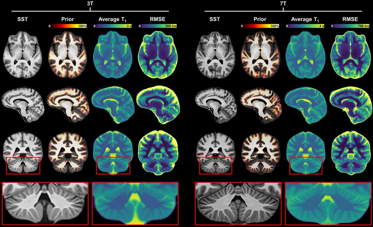 Happy to share that our latest publication "Submillimeter T1 atlas for subject‐specific abnormality detection at 7T" has been published in MRM. Free access here: onlinelibrary.wiley.com/share/author/Z….

#quantitativeMRI #ultrahighfieldMRI #T1mapping #siemenshealthineers #Inselspital