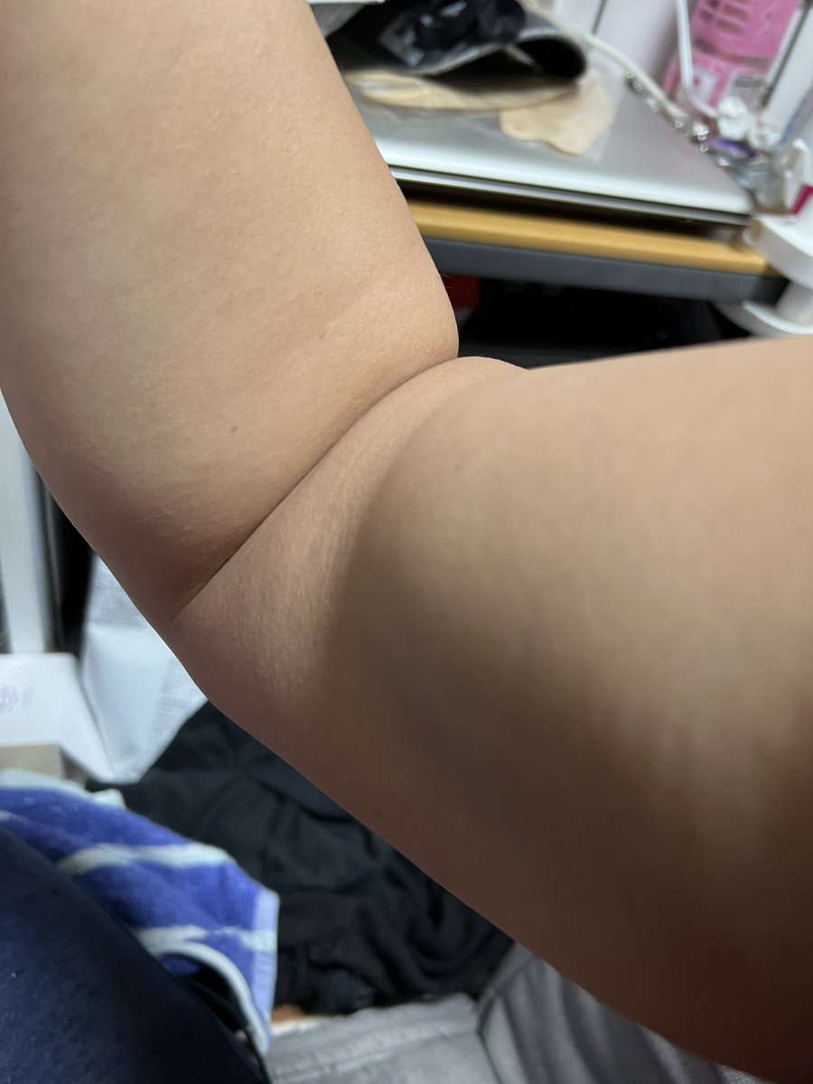 temberippo's tweet photo. リスナーに言われたので中間報告
ニ頭筋が育ってきました
わかりずらいねー
筋肉の自撮りがむずかしいことを知りましたw https://t.co/I32x3thPdN