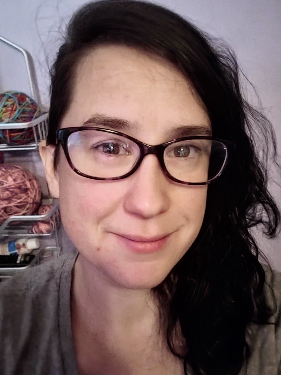 MissFoxKat's tweet photo. Already looking much better! Swelling is going down. https://t.co/wURil46Ke9