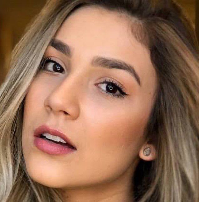 BrilhaBS_'s tweet image. A @brusantanareal esteve no consultório essa semana para fazer a manutenção do seu #preenchimentolabial 🧚

No carrossel, postei a evolução (não me mata Bru!) - para provar que ela ficou ainda mais linda! ❤️ via Instagram dragiuliadallagnese #brunasantana