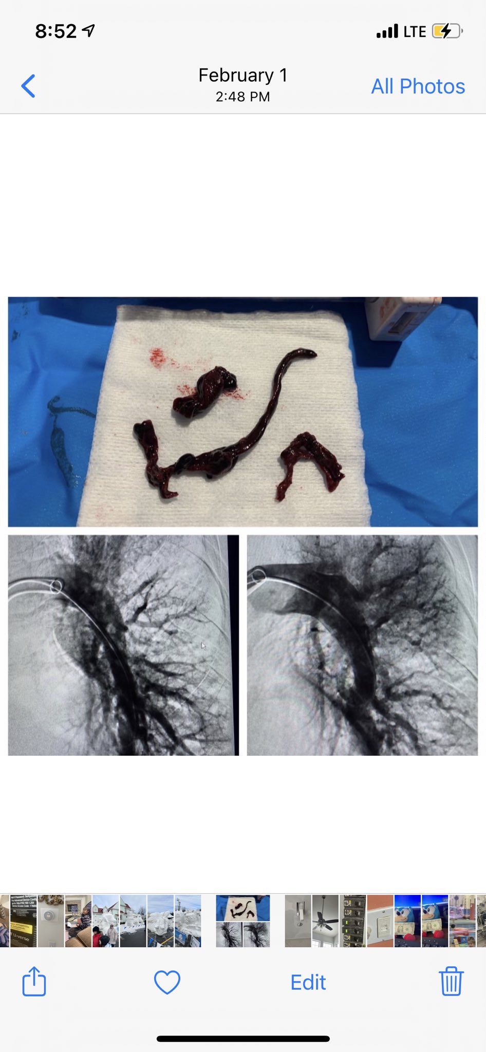 Retired Veteran on Twitter "MDMaloneRW elonmusk I came down with