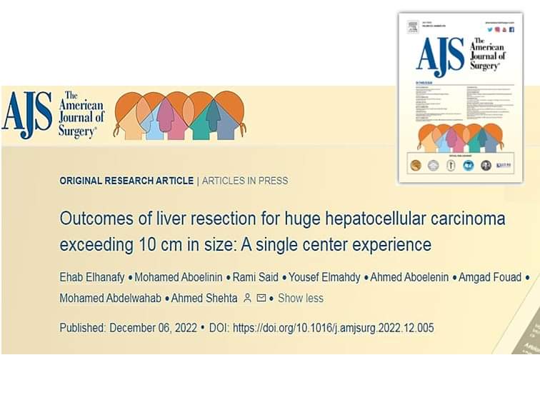 Ahmed_Shehta_eg's tweet image. Just published.. 
Outcomes of Liver Resection for Huge Hepatocellular Carcinoma Exceeding 10cm in Size

#GISC
#mansoura_university