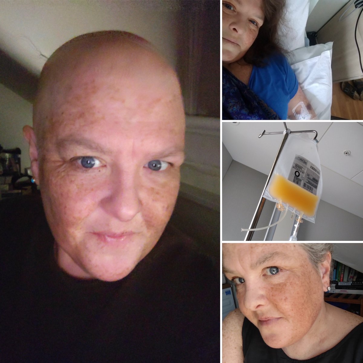 "Donating is the easiest thing in the world to do to save another person's life."

Your platelet donations help people with cancer like Shelley. She was diagnosed with leukaemia and needed more than 15 units of platelets during chemotherapy.

Learn more ➡️ bit.ly/2LagcAs