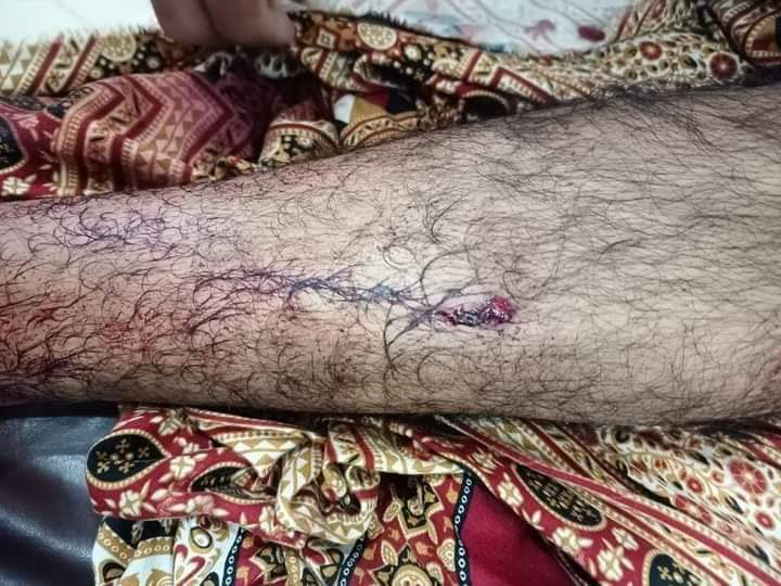 AamirHu68703969's tweet photo. ہم سٹوڈنٹس پر ہونے والے تشدد کے خلاف کراچی میں احتجاج ہورہا ہے مگر بہاولپور کی بے حس بے ضمیر عوام سو رہی ہے اور سے بھی بڑے بے حس ہم سٹوڈنٹس ہیں جو اپنی آواز بلند نہیں کر سکتے
ڈوب کر مرجانا چاہیے
ایسی تعلیم کا کیا فائدہ جو حق بولنے سے روکے
#Save_Iub_Students
#saveIUB https://t.co/cpy0kUxqyY