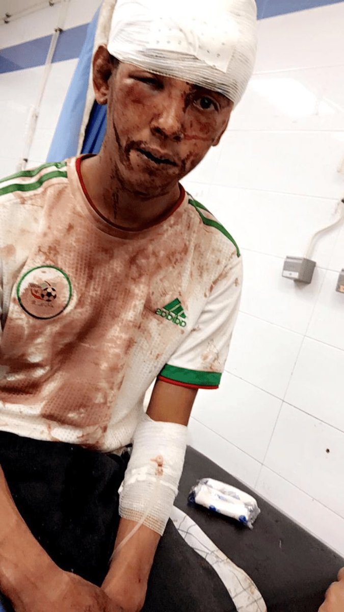 Ahora mismo miles de colonos marroquíes celebran su victoria en las calles del Sáhara ocupado, pero este joven saharaui, en 2019, salió a celebrar la victoria de la selección argelina en la copa africa y fue detenido, torturado y condenado a 16 años de cárcel por Marruecos.