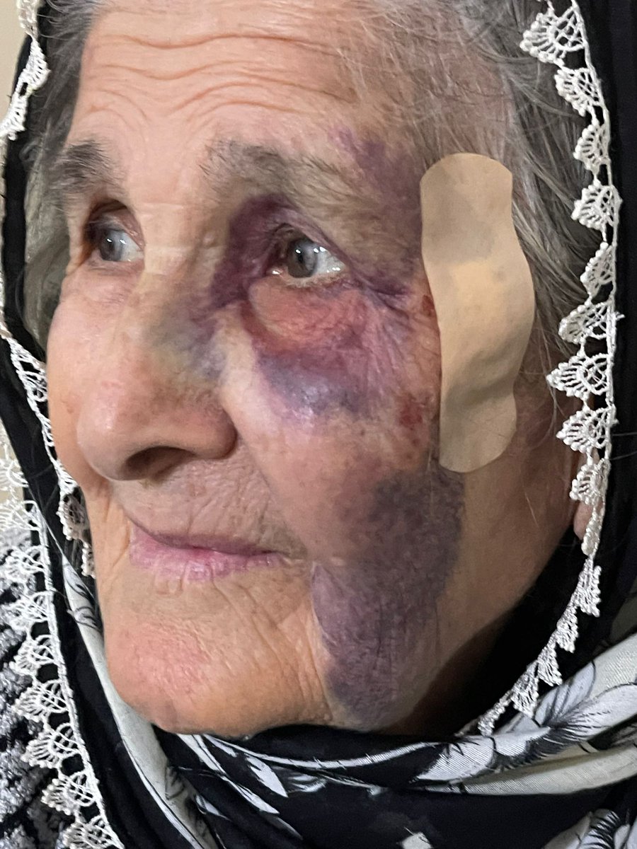 Dünya insan hakları gününde gördüğümüz şeye bakarmısınız?Annem cezaevinde tutuklu bulunan abimi ziyarete gitmiş ve başına geleni ben nasıl unutayım! Annem 79 yaşında ve cezaevi yollarında..