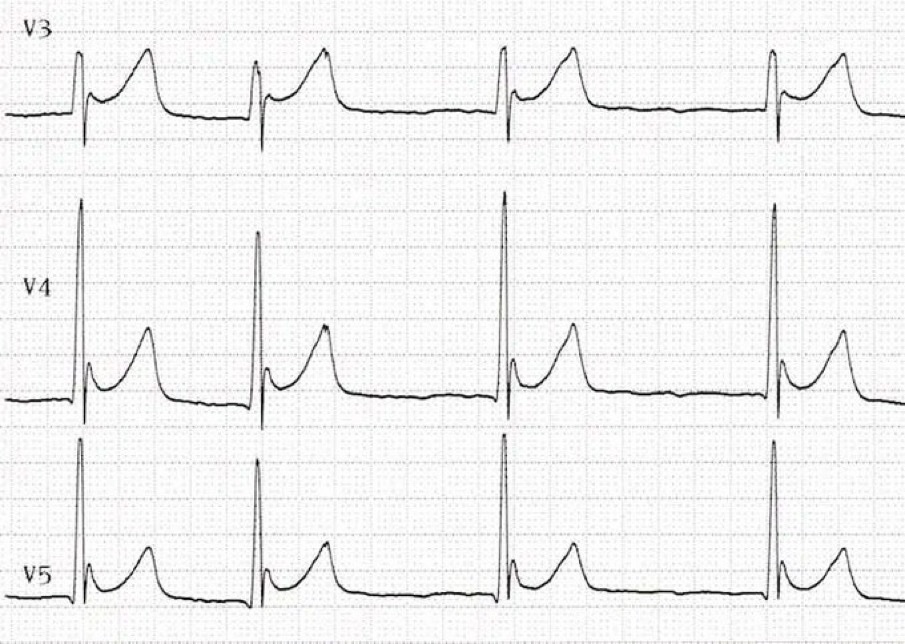 Journal of Brown Hospital Medicine tweet media