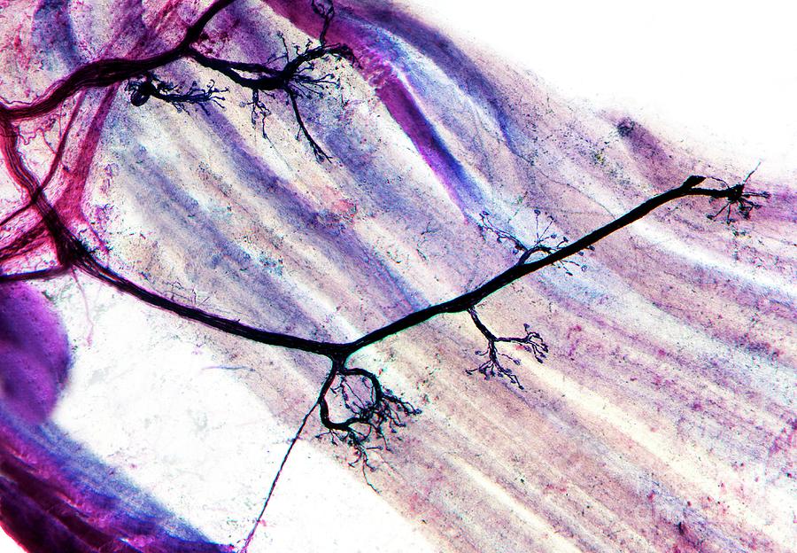 chrost_hugo's tweet image. Light micrograph of dendrites from motor nerve cells in muscle tissue (pink-purple strands).

Credits: Dr Keith Wheeler

#neuroscience #MedTwitter