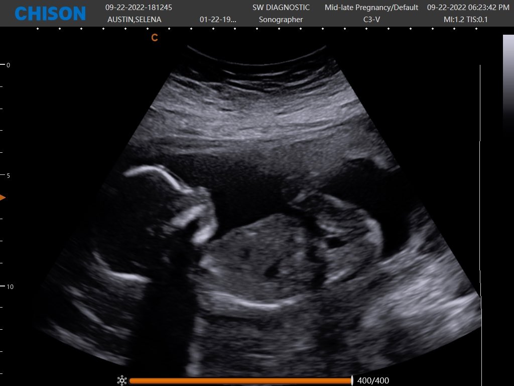2.5 months till I get to meet you😌🤍