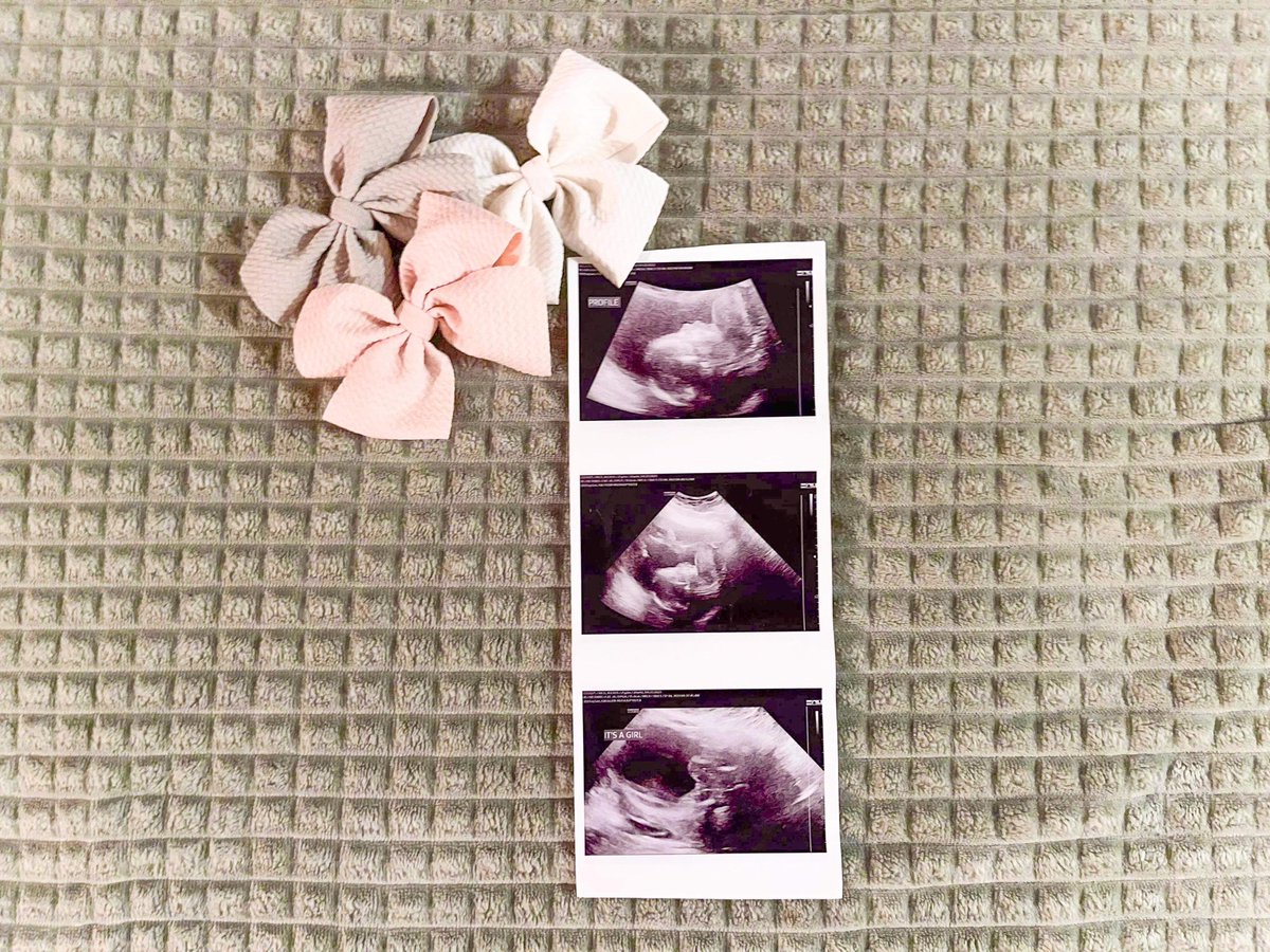 alexusmrico's tweet photo. So so excited for all life has in store for us🤍 https://t.co/U02nm4Y0ga