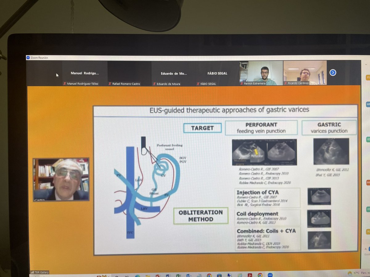 DigestivoHUVM's tweet photo. Conferencia magistral del #DrRafaelRomeroCastro en la reunión internacional de las Sociedades Brasileña, Portuguesa y Española de Endoscopia Digestiva sobre Hemorragia Digestiva. Genera un interés creciente el manejo global vascular guiado por Ecoendoscopia @SEEDendoscopia https://t.co/2gZyVodqIJ