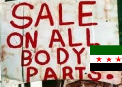 LPR Colonel Vitaly Kiselyov reports that “black transplantologists” known since 2014 for removing or...