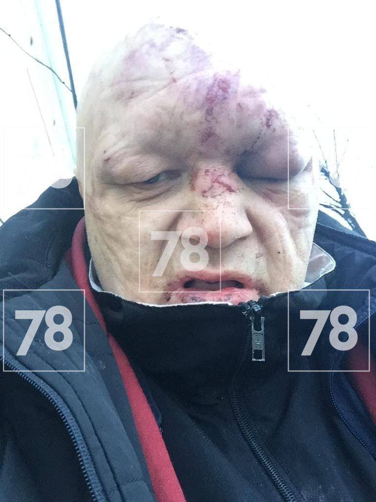 nexta_tv's tweet photo. Musician Stanislav #Baretsky, known for his Anti-Western, pro-Kremlin stance was beaten up in #SaintPetersburg. https://t.co/BhAZLbY13A