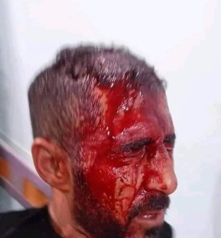 MohammadAldalfa's tweet photo. هكذا يهان المعلم في بلدي
محاضري وإداريي محافظة واسط هذا اليوم امام مديرية تربية واسط
التثبيت حق الجميع
@mohamedshia
#المحاضرين_والاداريين_وطن https://t.co/28nz8Wgv8N