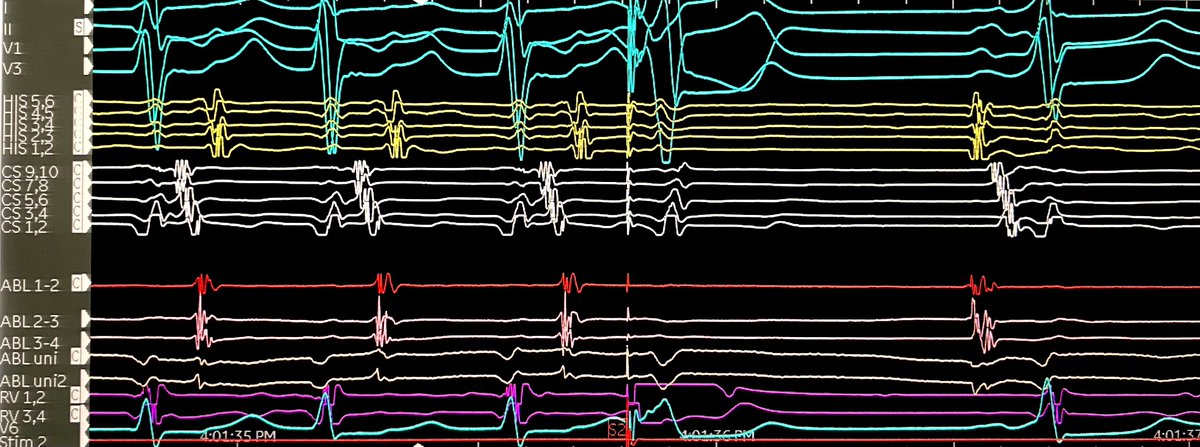 jeffrey_vinocur's tweet photo. #EPeeps keep saying that there are two many maps and not enough tracings 

What do you learn from this? #fellowsFirst poll below https://t.co/SfRbYgzcJI