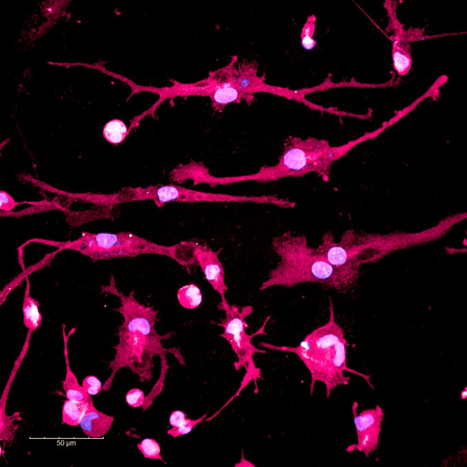 A splash of pink microglia from the @FerraiuoloLab 🔬

@CleideNeuro studies the brain’s immune cells & how they are affected by a gene mutation in motor neurone disease and frontotemporal dementia. This research could help identify new targets for treatments.

#ARUKImageOfTheWeek