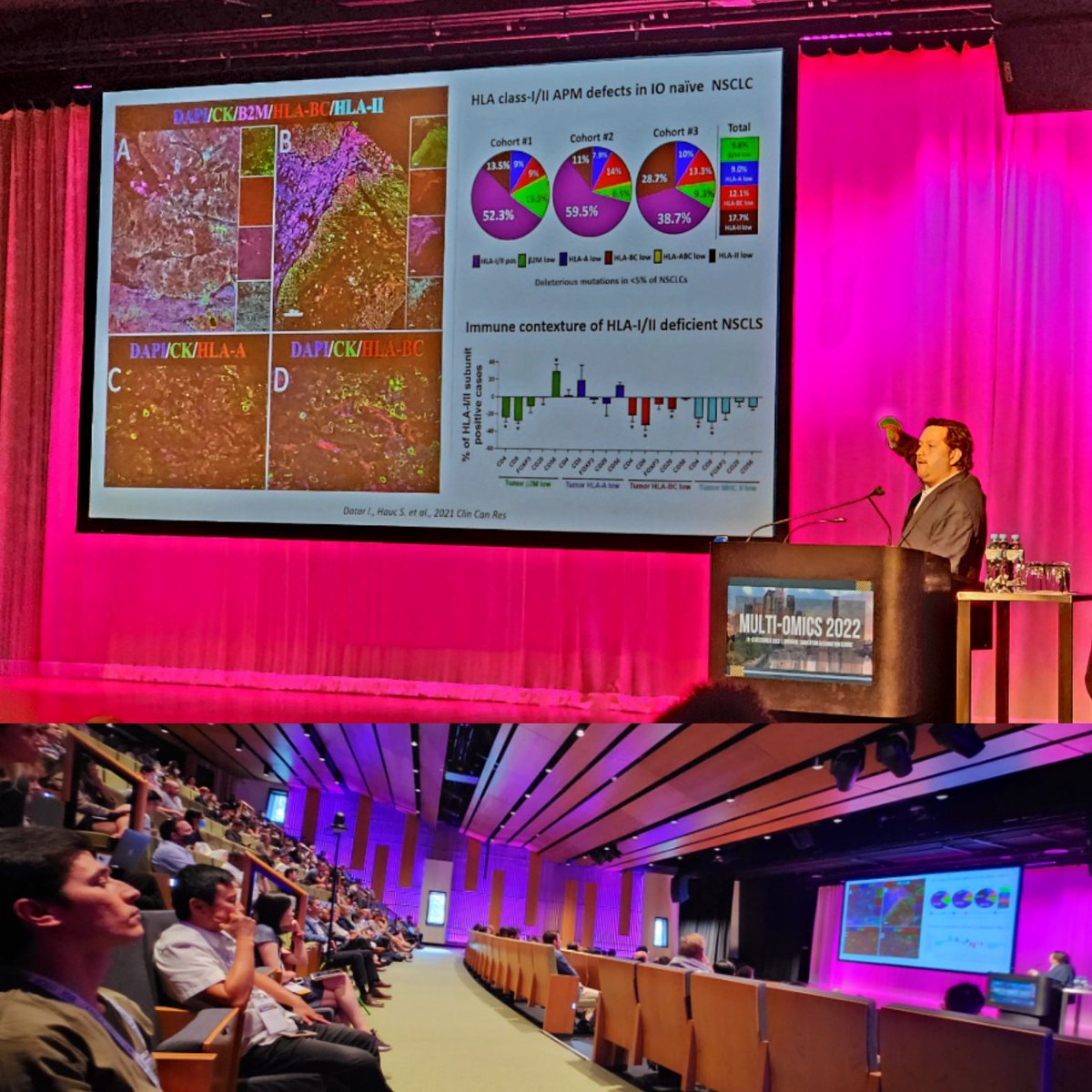 Arutha K (@aruthak) on Twitter photo Kurt Shalper <a href="/YaleMed/">Yale School of Medicine</a> "I believe what I can see" #MultiOmics22 <a href="/MULTI_OMICS2022/">MULTI-OMICS 2022</a> Kurt Shalper <a href="/YaleMed/">Yale School of Medicine</a> "I believe what I can see" #MultiOmics22 <a href="/MULTI_OMICS2022/">MULTI-OMICS 2022</a>