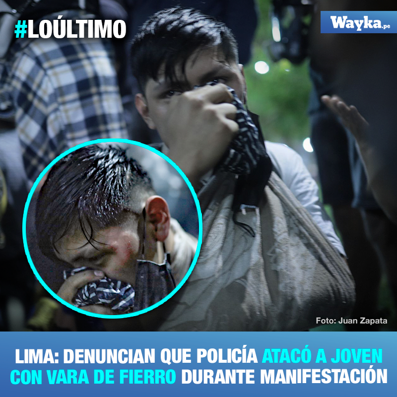 WaykaPeru's tweet photo. #LOÚLTIMO | Denuncian que policía atacó a joven con vara de fierro en la cabeza durante la manifestación en la plaza San Martín. El joven fue conducido a un hospital por personas que presenciaron el ataque.
📸 Juan Zapata
c.c. @PoliciaPeru @MininterPeru @Defensoria_Peru @ONUPeru https://t.co/YMu4hyvGdY