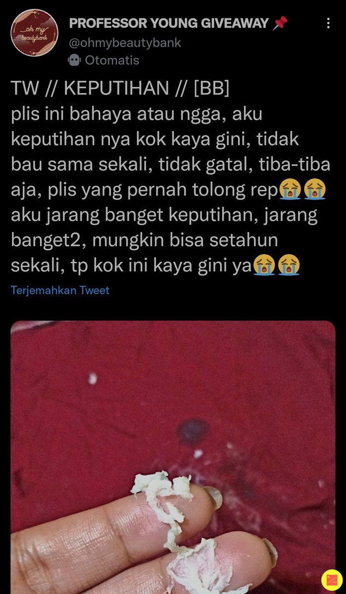 18! TW/KEPUTIHAN

Ini kok keputihan nya bisa sampe ke kasur kasur😭😭😭