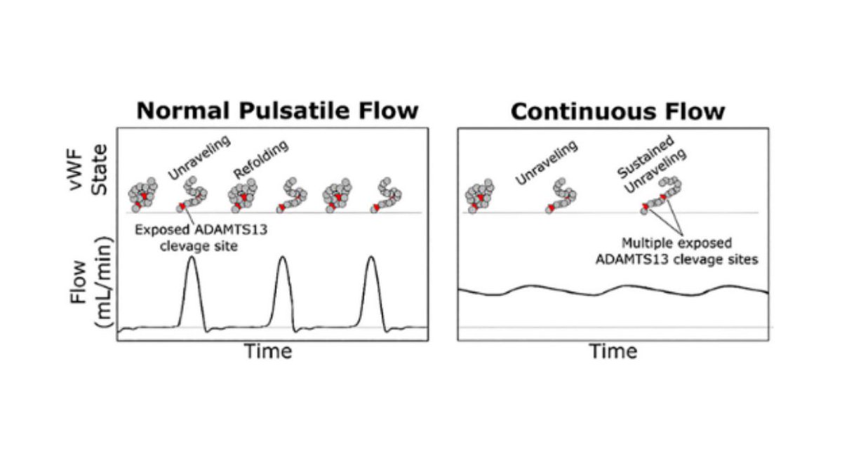 Loss of #Pulsatility with continuous-flow #LVADs and the significance of the arterial #Endothelium in #VonWillebrand factor production and degradation
👉bit.ly/3hcGBh7
@Uofl @Uabmedicine @Ianmightbecool @Bme_prof #ContinuousFlow