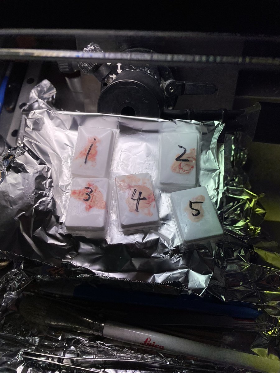 Last experiment in Japan before going back to CA, #spatialtranscriptomics #NasuHakola disease!
