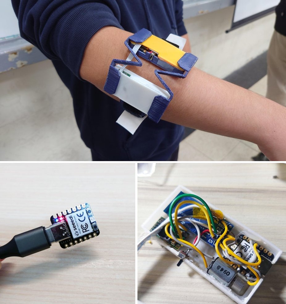 Wearable Device to Help With FoG Issues for Parkinson's made by Tobychui on <a href="/instructables/">instructables</a> using #XIAORP2040. With the help of some external stimulant like sound or vibration, patients can restore their normal walking gait very soon by following the rhythm.lnkd.in/g5jNN_tB