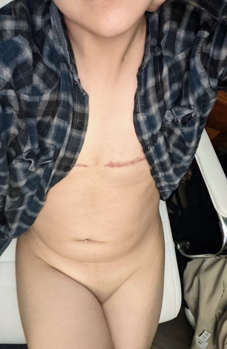 Body pic ;) #nude #nsfw #nsfwtwt #nsfwtw #trans #ftm #queer #naked #hot #sexy https://t.co/IdwzJQfS6<a href="/tag/nude"class="tags">#nude</a><a href="/tag/nsfw"class="tags">#nsfw</a><a href="/tag/nsfwtwt"class="tags">#nsfwtwt</a><a href="/tag/nsfwtw"class="tags">#nsfwtw</a><a href="/tag/trans"class="tags">#trans</a><a href="/tag/sexy"class="tags"><span>#sexy</span></a><a href="/tag/hot"class="tags"><span>#hot</span></a><a href="/tag/naked"class="tags"><span>#naked</span></a><a href="/tag/queer"class="tags"><span>#queer</span></a><a href="/tag/ftm"class="tags"><span>#ftm</span></a>