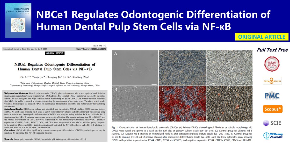 IntJStemCells's tweet photo. NBCe1 Regulates Odontogenic Differentiation of Human Dental Pulp Stem Cells via NF-κB
🌷https://t.co/kkdWAqrtlm
International Journal of Stem Cells 2022;15(4)Qin Li
#Dental_pulp_stem_cells #NBCe1 #Intracellular_pH #Odontogenic_differentiation #NF_κB https://t.co/OwDdxVNjT3