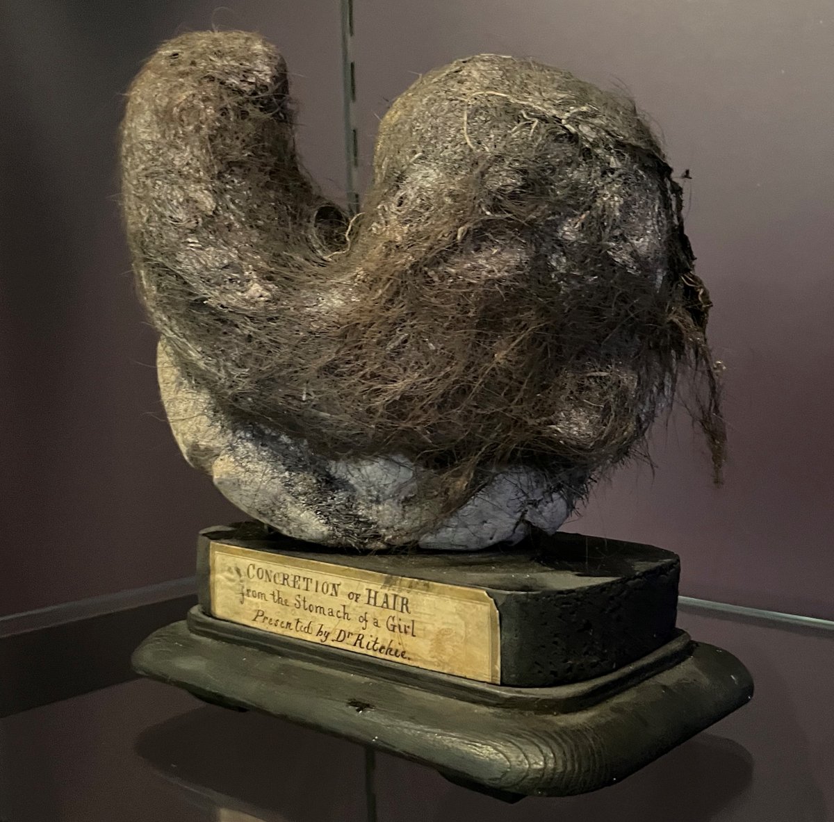 New blog! Exploring the history of dieting and weight control - through bezoar stones, the invention of weighing chairs and diet books #RecipeorRemedy (image credit: Hunterian Museum, Glasgow) rcpe.ac.uk/heritage/recip…