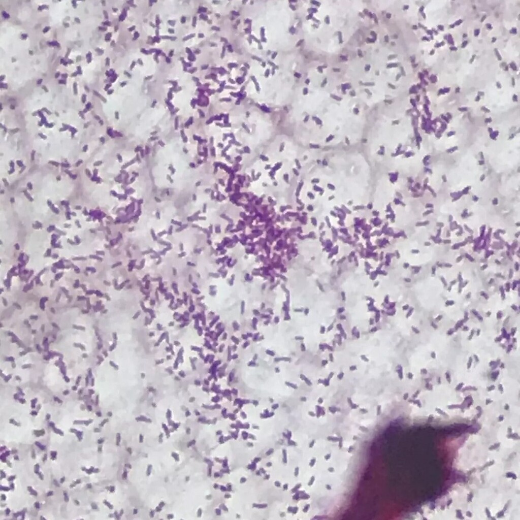 Microbiology 101 - Gram staining techniques - any guesses what it might be? #bristolbiohack #bristolhackspace instagr.am/p/CmD-TbUo336/