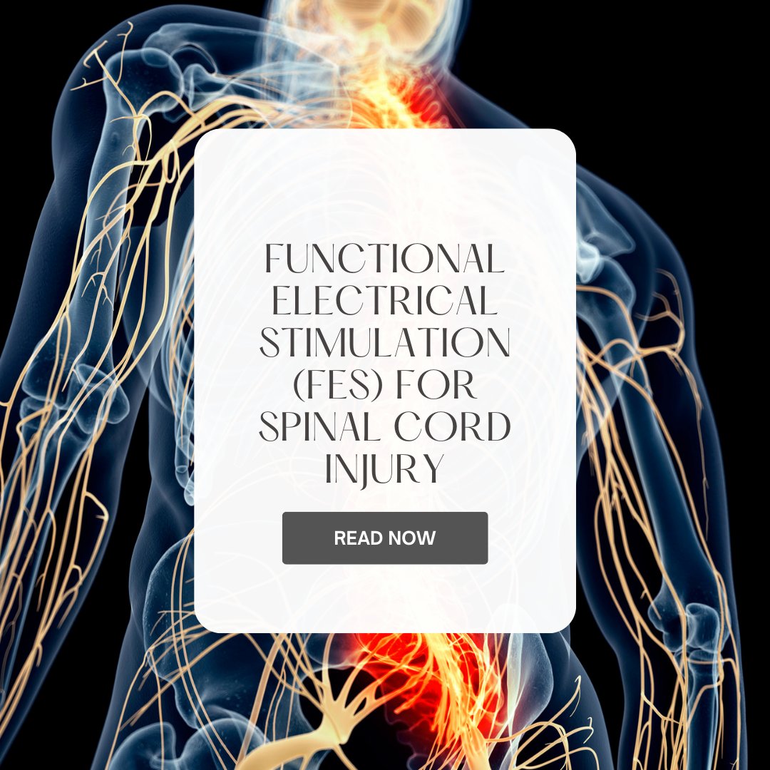 hands_physio's tweet image. Functional Electrical Stimulation is a method of treatment that uses a small charge of electric current to stimulate the body’s muscles that have become weakened or paralyzed due to damage to the spinal cord or brain. Find out how FES could help you. physiohealinghands.com/functional-ele…