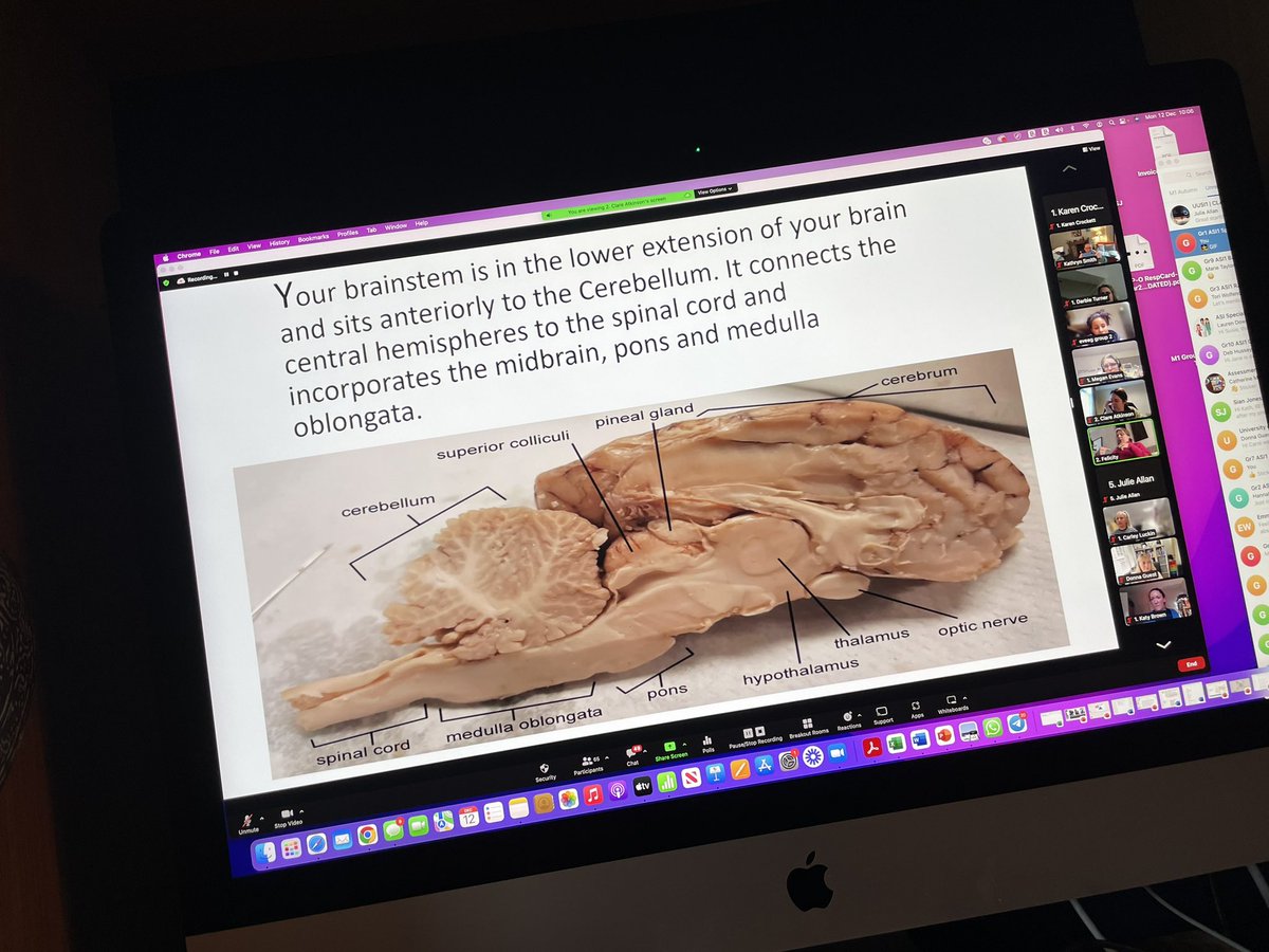 asi_wise's tweet photo. Our 2nd Module 1 presentation about neuro today was all about the Brainstem and we all enjoyed being reminded of the neuro anatomy. #sensoryintegration #MScAdvancingPractice @theRCOT @thecsp @RCSLT @kathsmithot @DevelopGrowOT @AniesaBlore @SensationalOT @pottedgarden1 @UlsterUni https://t.co/AaLQ4w0ZnN