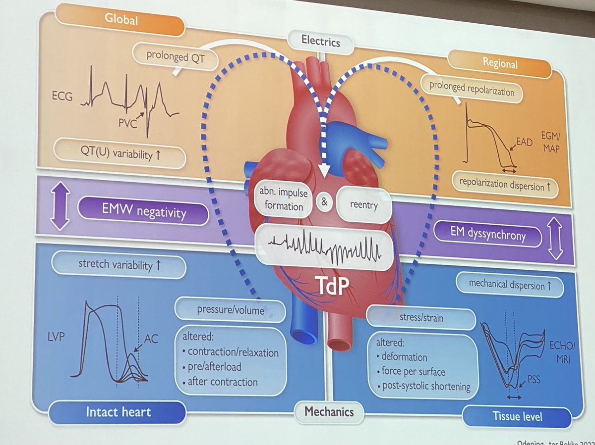 Leema_Robert (@robert_leema) on Twitter photo Looking at mechanical stressors in LQT. Electromechanical window (EMW) is something that we look for in ECGs to use with further validation for risk prediction @AiccUk <a href="/2tbueser/">Dr Tootie Bueser💙</a> <a href="/rach_bastiaenen/">Rachel Bastiaenen</a> <a href="/nursetobes/">Liam Tobin</a> Looking at mechanical stressors in LQT. Electromechanical window (EMW) is something that we look for in ECGs to use with further validation for risk prediction @AiccUk <a href="/2tbueser/">Dr Tootie Bueser💙</a> <a href="/rach_bastiaenen/">Rachel Bastiaenen</a> <a href="/nursetobes/">Liam Tobin</a>