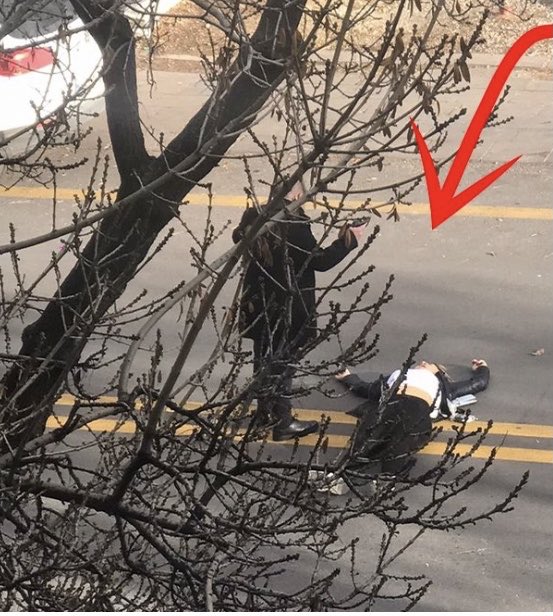 Yerde yaran kadın pandemi sürecinde mahallemize taşınmış komşumuz Pelin Ceylan. Sabahları köpekleri gezdirirken karşılaşır, selamlaşırdık.Şimdi bedeninde  4 kurşunla ameliyatta ölüm kalım kavgası veriyor.+++