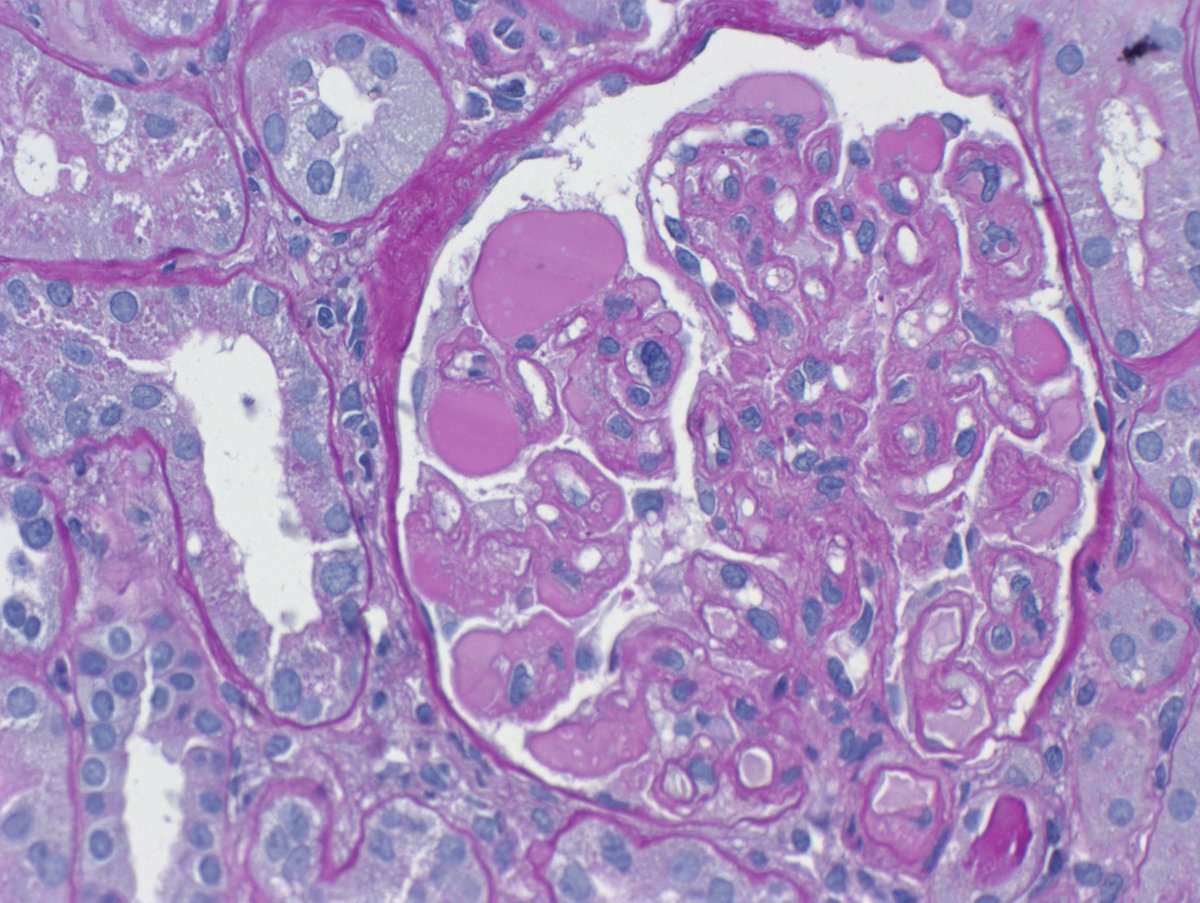 Kuang-Yu Jen, MD, PhD tweet media