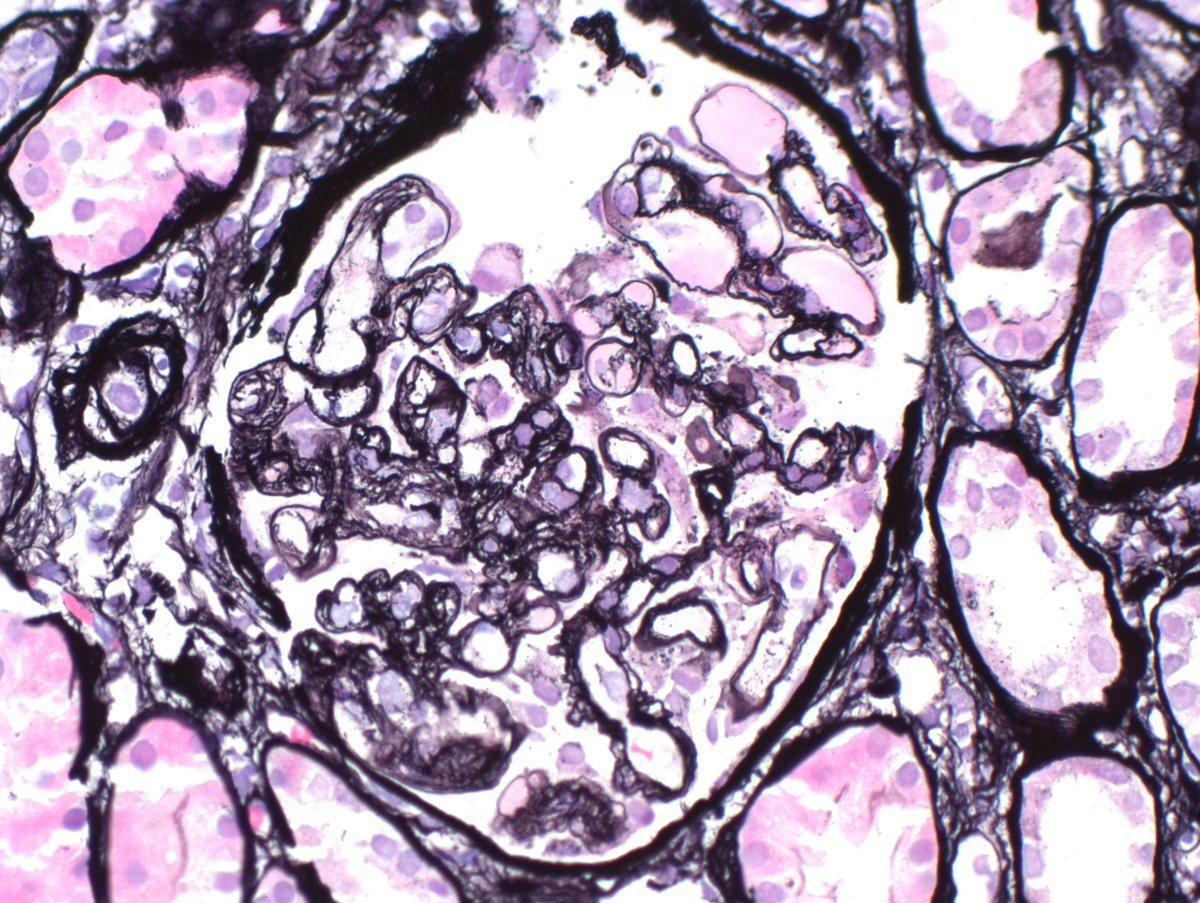 Kuang-Yu Jen, MD, PhD tweet media