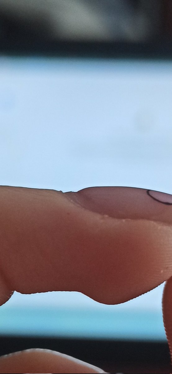 wojakdynx's tweet photo. czy znajdzie się ktoś kto zna się na rzeczy i podpowie mi czy coś z paznokciami przy odroscie jest nie tak? martwi mnie to bardzo wyglądaja i w dotyku są jak dziury ale nikt nie widzi problemu? #paznokcie #hybrydy https://t.co/a7XR3N8Fl6