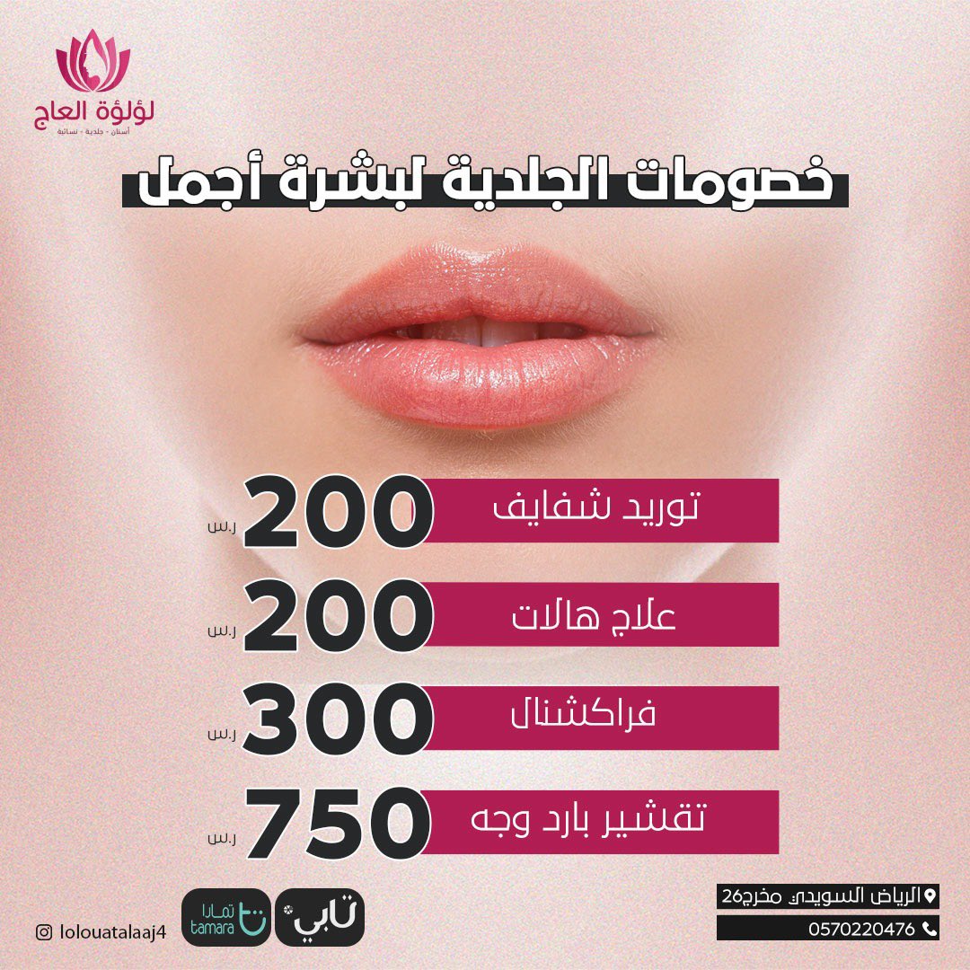 lolouat's tweet photo. عروض نهاية العام #عروض_نهاية_العام  
لؤلؤة العاج السويدي
#لؤلؤة_العاج_السويدي 
#دكتور_كلية_طب_مؤتة 
#الرياض_الان 

#الخميس_الونيس
#فضيحه_نوره_الدوسري
#امك_كم_عمرها 

#جده_lلان #ابتسام_المقرشية #اضراب_سائقي_الشاحنات #المغرب_فرنسا #الاهلي  

 #زواج_عبدالله_دخيل_الله https://t.co/4xjWS7S1Cc