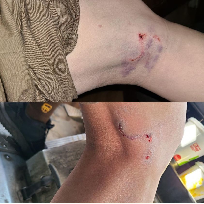 This time of year, many of us are getting packages and meals delivered to our homes. Two drivers were bit on Saturday alone!  Please make sure to keep your dogs in a safe place so they do not chase or attack delivery drivers.