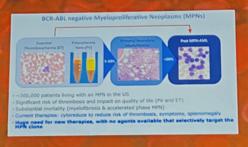 doctorpemm's tweet photo. #ASH22 Outstanding teaching overview slide Dr @beth_psaila as #ASHPlenary introducer for #MPNSM | #JAK2 #CALR #MPL https://t.co/hcLXiK20jW