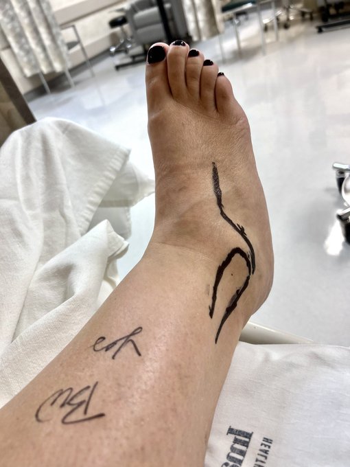 2 pic. Greetings from the hospital, about to get major foot surgery today, won’t be able to walk (or
