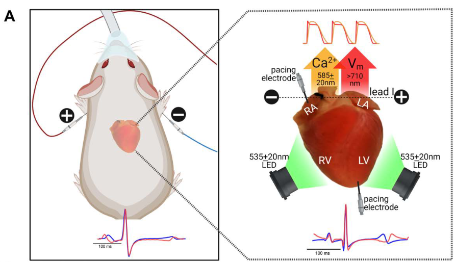APS Publications (@apspublications) on Twitter photo The effect of sex and age on ex vivo cardiac #electrophysiology: insight from a guinea pig model (<a href="/kazithaq1/">kazi t haq</a>, <a href="/BlakeCoop1/">Blake Cooper</a>, <a href="/NikkiPosnack/">Nikki Gillum Posnack</a> et al. <a href="/ChildrensNatl/">Children's National Hospital π₯</a>) - new in <a href="/ajpheartcirc/">AJP-Heart and Circ</a>
ow.ly/kZNe50M1rau
#electrocardiogram The effect of sex and age on ex vivo cardiac #electrophysiology: insight from a guinea pig model (<a href="/kazithaq1/">kazi t haq</a>, <a href="/BlakeCoop1/">Blake Cooper</a>, <a href="/NikkiPosnack/">Nikki Gillum Posnack</a> et al. <a href="/ChildrensNatl/">Children's National Hospital π₯</a>) - new in <a href="/ajpheartcirc/">AJP-Heart and Circ</a>
ow.ly/kZNe50M1rau
#electrocardiogram