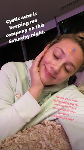 LivealikeFR's tweet photo. #Acné : découvrez l'astuce de #LilyReinhart et #milliebobbybrown
https://t.co/MzaQM6gFBS https://t.co/ym0w9l3Hbb