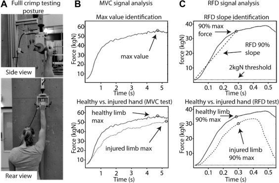 DominicOrth's tweet image. 'Unilateral Force Production Deficits Following Hand Injury In Experienced Climbers: A Reliability And Retrospective Injury Study'
been a while on tech detox - but a new paper out looking at unilateral strength in previously injured climbers- 50 day link authors.elsevier.com/a/1gEic3risBCC…